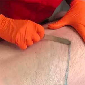 Gentlemen's Hair Removal